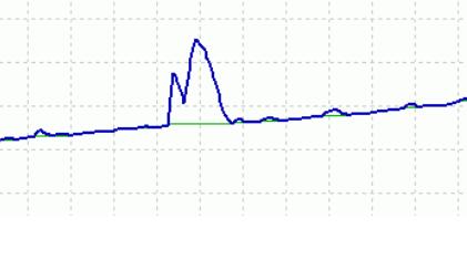  Scalping Strategy System V2.0 EA