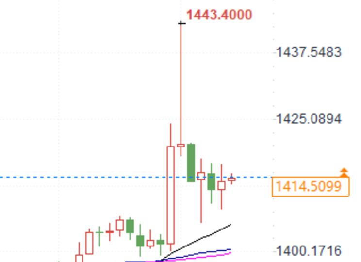 Can ADP data create a storm? Gold, crude oil, foreign exchange, and bond markets are poised to take off!